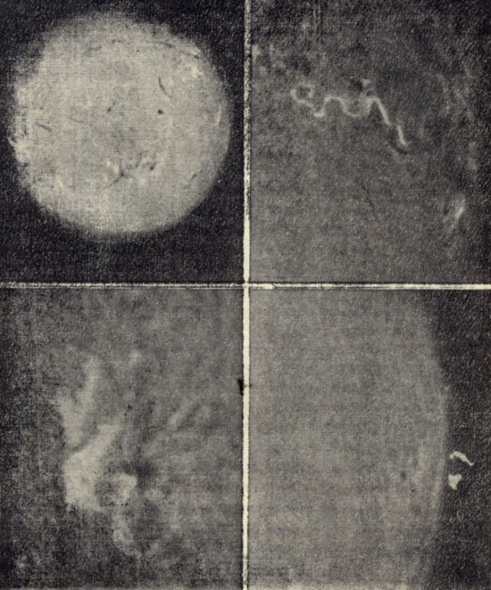 Рис. 132. Фотографии четырех солнечных вспышек в свете бальмеровской линии водорода Нα